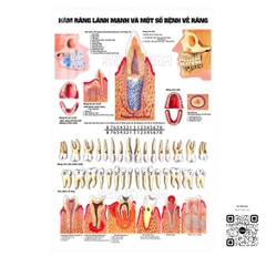 Tranh Hàm răng lành mạnh và một số bệnh về răng