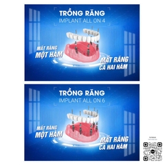 Tranh "Trồng răng implant all on 4", " Trồng răng implant all on 6"