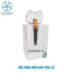 Mô hình implant pha lê