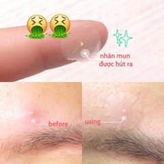 Some By Mi Miếng dán mụn Clear Spot Patch - Túi 18 miếng