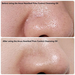 Dầu tẩy trang diếp cá Anua Heartleaf Pore Control Cleansing Oil 200ml