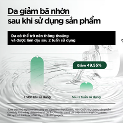 Nước hoa hồng dưỡng da Anua Heartleaf 77+ Soothing Toner 250ml