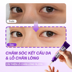 Kem dưỡng mắt Some By Mi Retinol Intense Advanced Triple Action Eye Cream 30ml