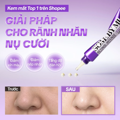 Kem dưỡng mắt Some By Mi Retinol Intense Advanced Triple Action Eye Cream 30ml