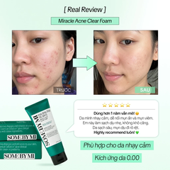 Sữa rửa mặt Some By Mi AHA-BHA-PHA 30 Days Miracle Acne Clear Foam 100ml