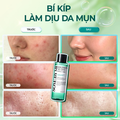 Nước hoa hồng Some By Mi AHA-BHA-PHA 30 Days Miracle Toner 150ml