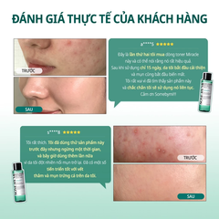 Nước hoa hồng Some By Mi AHA-BHA-PHA 30 Days Miracle Toner 150ml