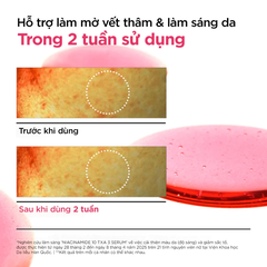 Tinh chất Anua Niacinamide 10 + TXA 3 Serum 30ml