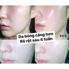 Tẩy Tế Bào Chết Hóa Học Dạng Gel CNP Laboratory Invisible Peeling Booster Essence