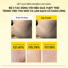 Kem dưỡng  Mary & May Spicule PDRN Cream 15g