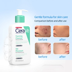 SỮA RỬA MẶT CERAVE
