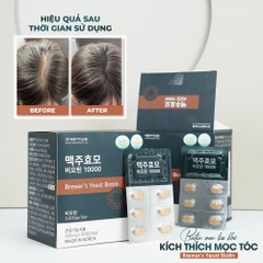 Thực phẩm Brewer's Yeast Biotin 10000