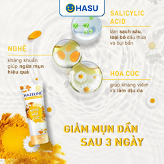 Sữa rửa mặt Hazeline  Nghệ Hoa Cúc Chiết Xuất Thiên Nhiên Ngừa Mụn Sáng Da 100g