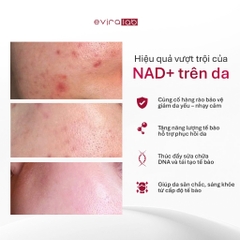 Mặt nạ Phục hồi Eviralab NAD+ Skin Renewal Mask Cấp ẩm, Làm dịu, Tái tạo da