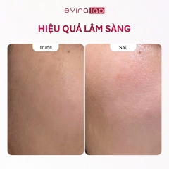 Mặt nạ Trắng da Eviralab TXA+ Skin Whitening Mask Cải thiện sạm nám, Đều màu da