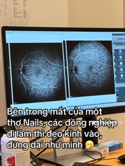 Nguy hiểm khi làm nail 12 tiếng mỗi ngày của cửa hàng đông khách