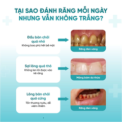 Bàn chải Royalead chuôi lỗ màu xanh lá