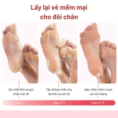 mat-na-u-chan-teemoon-tay-te-bao-chet-lao-hoa-chong-nut-ne-huong-hoa-lavender-2-