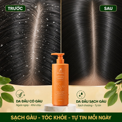 Cặp dầu gội xả Hyamin sạch gàu ngứa, nhỏ gọn 350ml