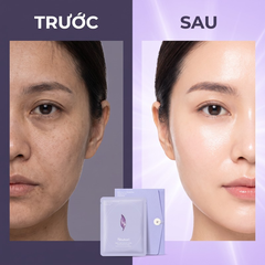 Mặt nạ SHUHARI phục hồi chuyên sâu cấp ẩm mềm mịn 40ml