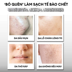 Tẩy tế bào chết kết hợp mặt nạ 2in1 Exfoliation Cream 40g