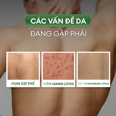 Xịt giảm mụn và mờ thâm cơ thể Exfoliating Body Spray 100ml