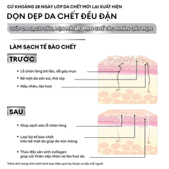 Tẩy tế bào chết kết hợp mặt nạ 2in1 Exfoliation Cream 40g