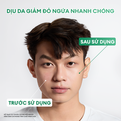Kem dưỡng ẩm B5 & Bioactive Derma Pro giúp phục hồi da sau mụn, da khô, da nhạy cảm 50g