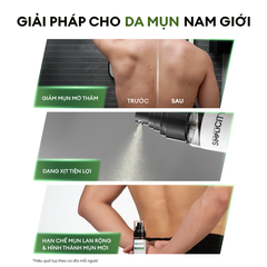 Xịt giảm mụn và mờ thâm cơ thể Exfoliating Body Spray 100ml
