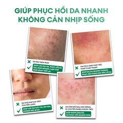 Kem dưỡng ẩm B5 & Bioactive Derma Pro giúp phục hồi da sau mụn, da khô, da nhạy cảm 50g