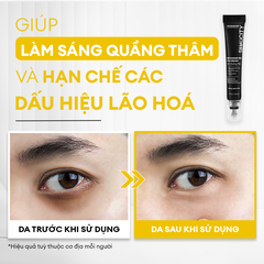 Kem mắt Recharge Pro dưỡng sáng, ngừa quầng thâm và nếp nhăn 15G