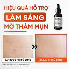 Combo mờ thâm sáng da tiêu chuẩn Brightening Trio