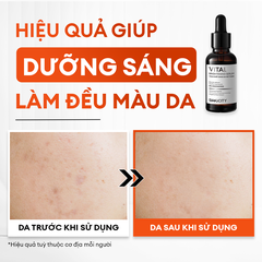 Combo Brightening Duo dưỡng trắng mờ thâm tiết kiệm: Sữa rửa mặt 100g & Serum Vital 30ml