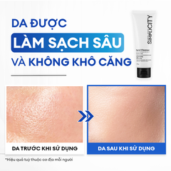 Sữa rửa mặt sạch dầu nhờn & ngừa mụn 100G