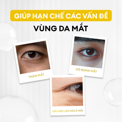 Kem mắt Recharge Pro dưỡng sáng, ngừa quầng thâm và nếp nhăn 15G