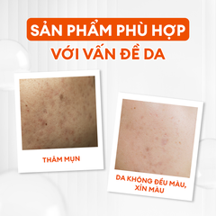 Serum Vital dưỡng trắng mờ thâm phức hợp Peptide + 5% Niacinamide 30ml