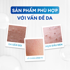 Combo Acne Trio chăm da dầu mụn: Sữa rửa mặt 100g, Serum Calm 30ml, Kem dưỡng ẩm 80g