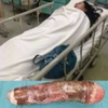 Tự chế đồ chơi tình dục để sử dụng và cái kết ...