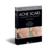 Sách ACNE SCARS:Classification and Treatment