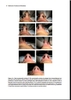 Sách Miniinvasive Techniques in Rhinoplasty ̣̣( Kỹ thuật Miniinvasive trong nâng mũi )