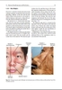 Sách Clinical Anatomy of the Face for Filler and Botulinum Toxin Injection