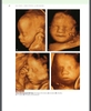 Sách atlas of ultrasound in obstetrics and gynecology: a multimedia reference second edition