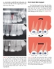 Chỉnh nha : Sổ tay lâm sàng về Mini-implant