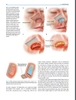 Sách  principles of Nasal Reconstruction