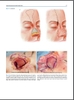 Sách  principles of Nasal Reconstruction