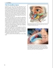 Sách Facial Volumization: An Anatomic Approach