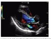 Sách ma and mateer's emergency ultrasound