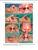 Sách  principles of Nasal Reconstruction