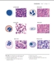 Sách Dermatopathology: diagnosis by first impression