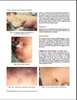 Sách Color Atlas and Synopsis of Pediatric Dermatology